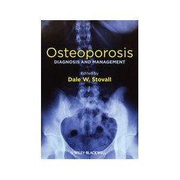 Osteoporosis: Diagnosis and...