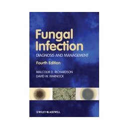 Fungal Infection: Diagnosis...