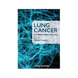 Lung Cancer: A...