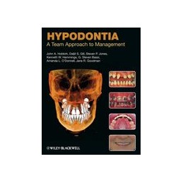 Hypodontia: A Team Approach...