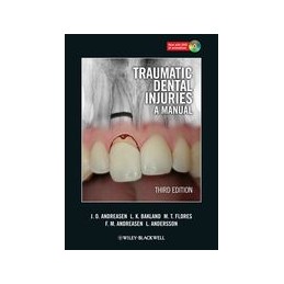 Traumatic Dental Injuries: A Manual