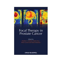 Focal Therapy in Prostate...