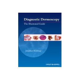 Diagnostic Dermoscopy: The...