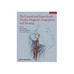 The Carotid and Supra-Aortic Trunks: Diagnosis, Angioplasty and Stenting