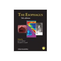 The Esophagus