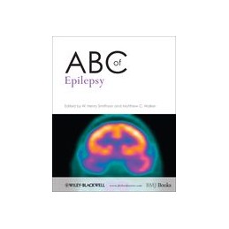 ABC of Epilepsy