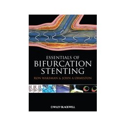 Bifurcation Stenting