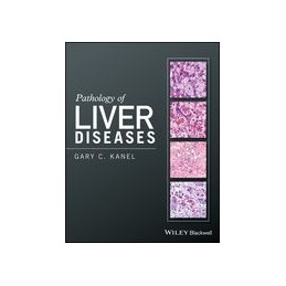 Pathology of Liver Diseases