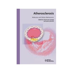 Atherosclerosis: Molecular...