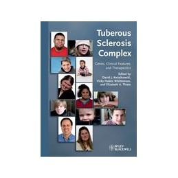 Tuberous Sclerosis Complex: Genes, Clinical Features and Therapeutics