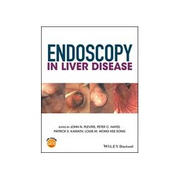 Endoscopy in Liver Disease