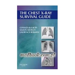 The Chest X-Ray Survival Guide