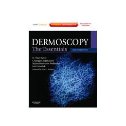 Dermoscopy