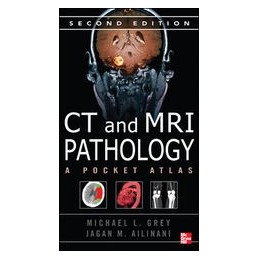 CT & MRI Pathology: A Pocket Atlas, Second Edition ISE