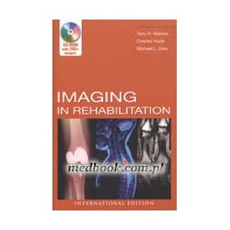 Imaging Rehabilitation ISE
