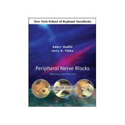 Peripheral Nerve Blocks: Principles and Practice