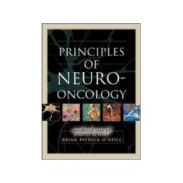 Principles of Neuro-Oncology