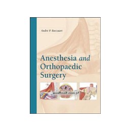 Anesthesia and Orthopaedic Surgery