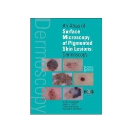 An Atlas of Surface Microscopy of Pigmented Skin Lesions: Dermoscopy