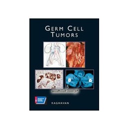 Germ Cell Tumors