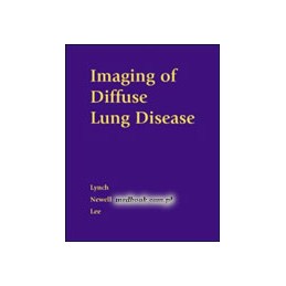 Imaging of Diffuse Lung Disease
