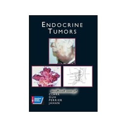 Endocrine Tumors