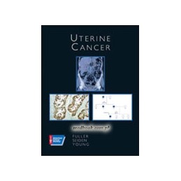 Uterine Cancer