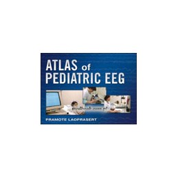 Atlas of Pediatric EEG