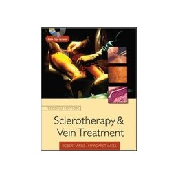 Sclerotherapy and Vein...