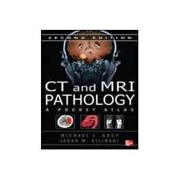 CT & MRI Pathology: A Pocket Atlas, Second Edition (Int'l Ed)