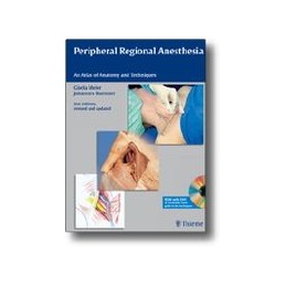 Peripheral Regional Anesthesia