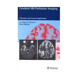 Cerebral MR Perfusion...