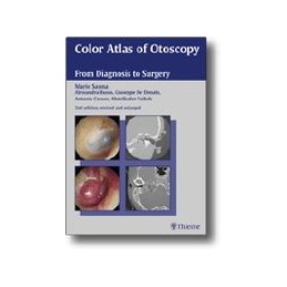 Color Atlas of Otoscopy