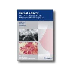 Breast Cancer - The Art and Science of Early Detection with Mammography