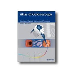 Atlas of Colonoscopy