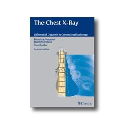 The Chest X-Ray