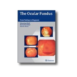 The Ocular Fundus