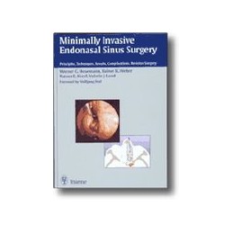 Minimally Invasive Endonasal Sinus Surgery