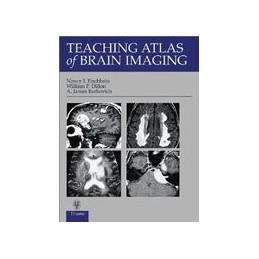 Teaching Atlas of Brain...