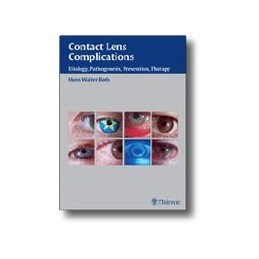 Contact Lens Complications