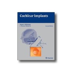 Cochlear Implants