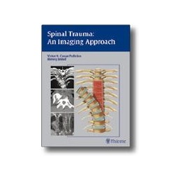 Spinal Trauma - An Imaging...