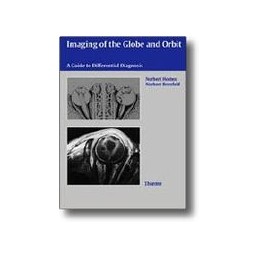 Imaging of the Globe and Orbit