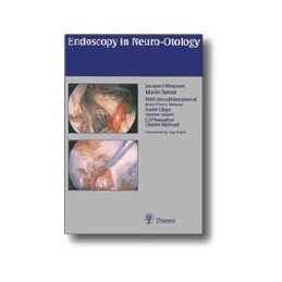 Endoscopy in Neuro-Otology