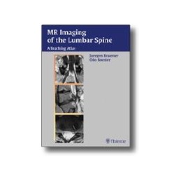 MR Imaging of the Lumbar Spine