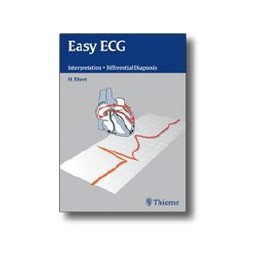 Easy ECG