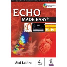 Echo Made Easy