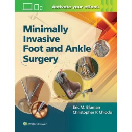Minimally Invasive Foot &...