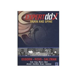 EXPERTddx: Brain and Spine