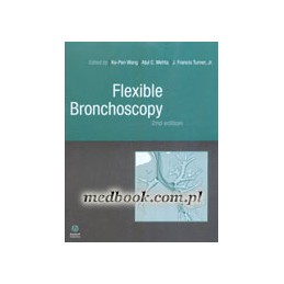 Flexible Bronchoscopy 2e